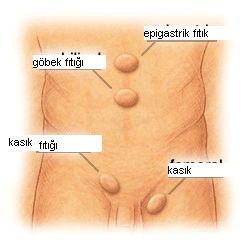 http://www.gastroendoskopi.com/mynet_resimlerim/fitiklar.jpg
